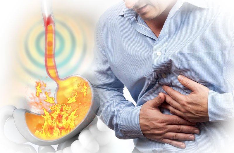 Colic & Reflux Treatment 7 Colic Reflux Treatment 7