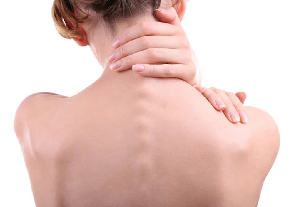 Scoliosis Screening & Management 3 Scoliosis Screening Management 3