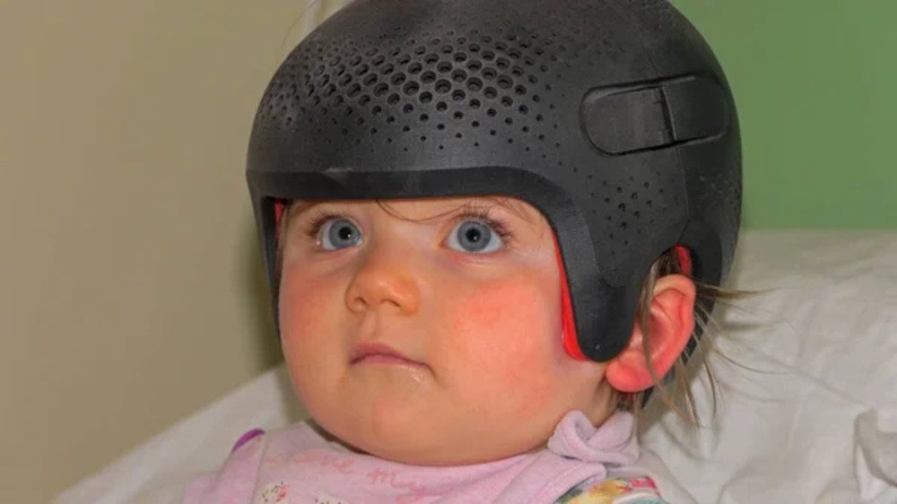 Torticollis & Plagiocephaly Correction 3 Torticollis Plagiocephaly Correction 3